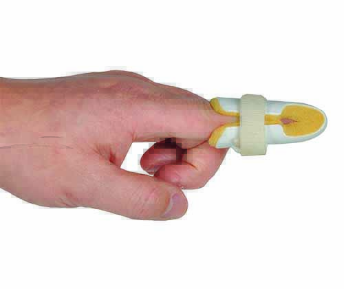 SH-265指骨夹板塑料两片型